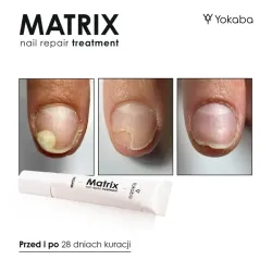 YOKABA Matrix Nail Repair Treatment - preparat do regeneracji macierzy paznokcia 15ml