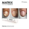 YOKABA Matrix Nail Repair Treatment - preparat do regeneracji macierzy paznokcia 15ml