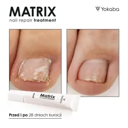 YOKABA Matrix Nail Repair Treatment - preparat do regeneracji macierzy paznokcia 15ml