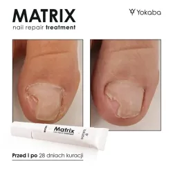 YOKABA Matrix Nail Repair Treatment - preparat do regeneracji macierzy paznokcia 15ml