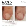 YOKABA Matrix Nail Repair Treatment - preparat do regeneracji macierzy paznokcia 15ml